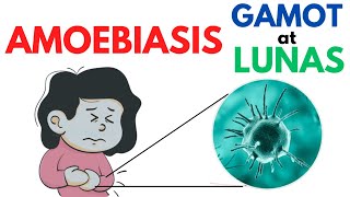 ? Gamot at Lunas sa Amoebiasis | Mga Sintomas, Home Remedies, Paano nakukuha