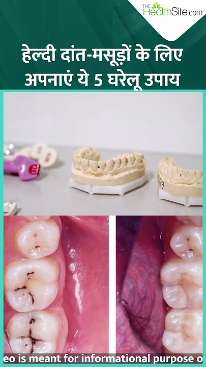 Home Remedies For Healthy Teeth: Healthy दांतों और मसूड़ों के लिए अपनाएं ये 5 घरेलू उपाय