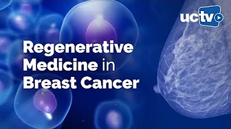 Stem Cells and Precision Regenerative Medicine in Breast Cancer