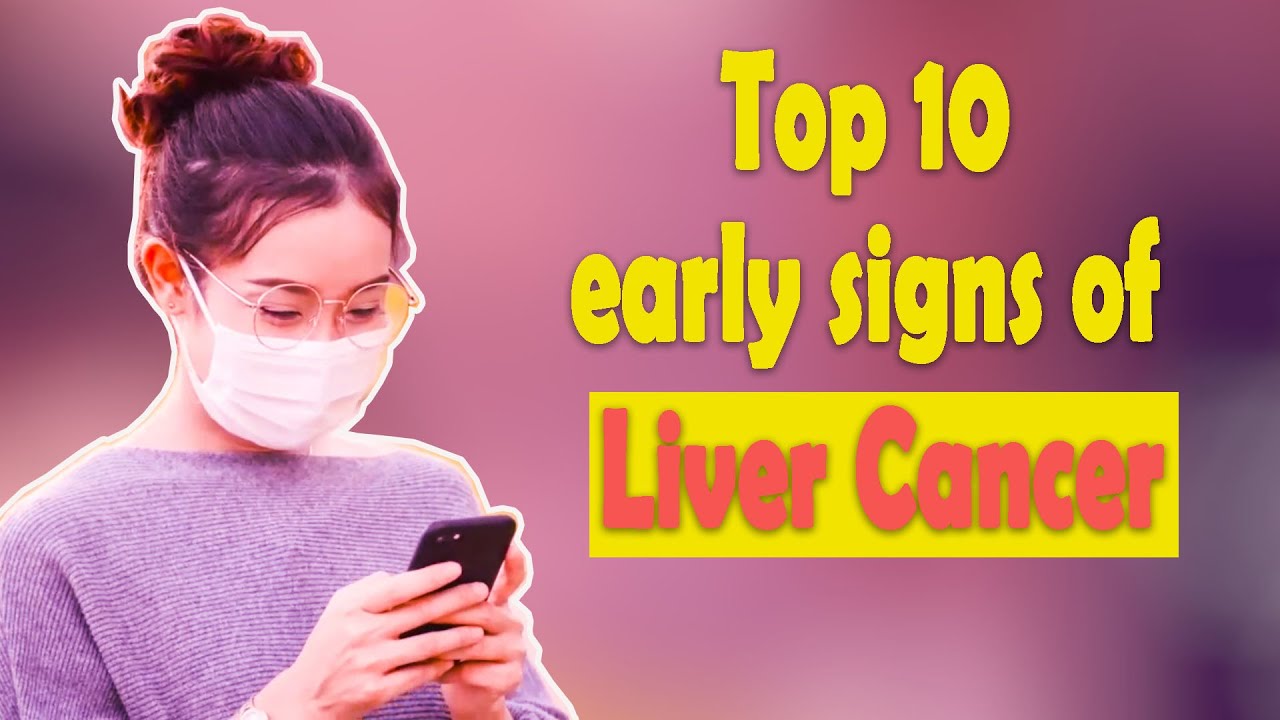 Top 10 early signs of liver cancer YouTube