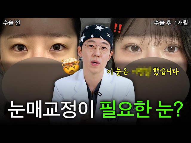 눈매교정 필요한 눈은 OOOO(4K) ｜ 눈성형 문제집💡