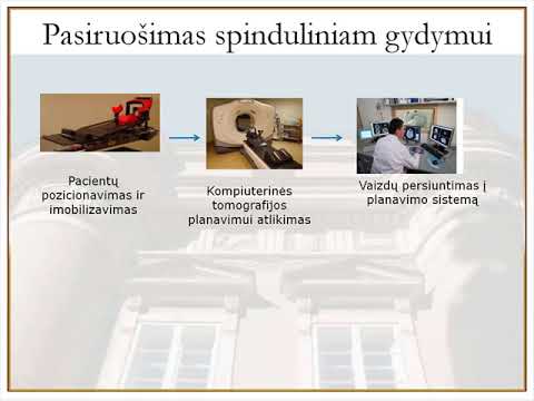 Video: Gimdos Kaklelio Leukoplakija - Gydymas