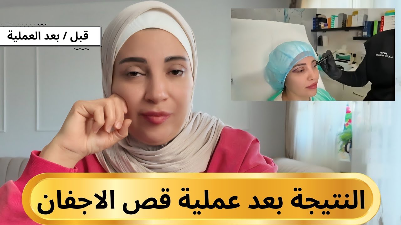 حمزة وسمر | النتيجة بعد قص الأجفان… نصيحتي من التجربة