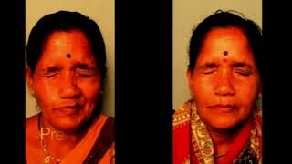 AIOC2018 - IC532 - Topic - Functional Indications : Facial Spasms - Dr.Milind Naik