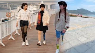Unstoppable Spirit Amputee Woman s First Steps on a Prosthetic Leg