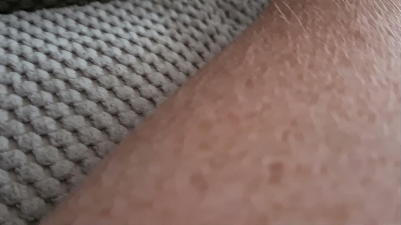 Muscle twitching after Covid Jab YouTube