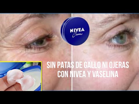 Vídeo: Marimar Kiroa - Bloguero De Belleza De 21 Años Con Una Gran Hinchazón En La Cara - Vista Alternativa