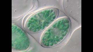 Glaucophytes