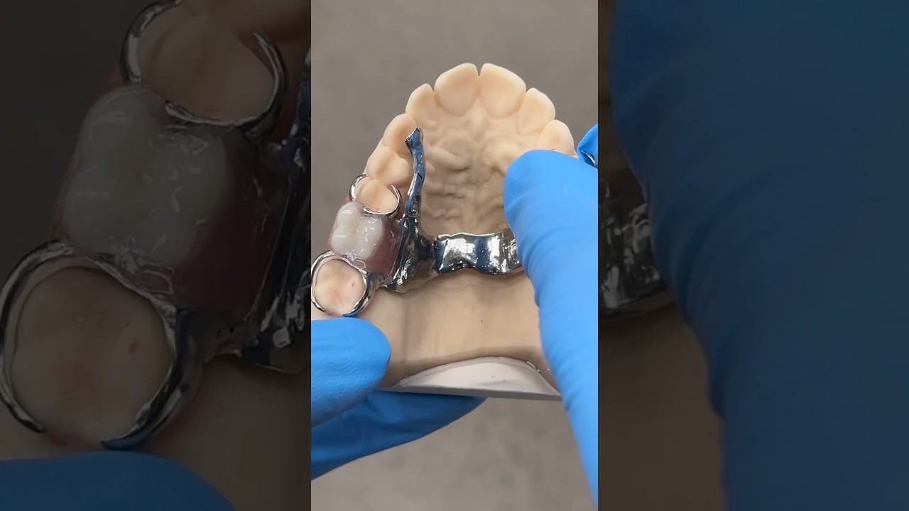 Chrome Cobalt Process Partial 