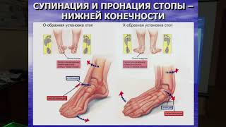 Лекция В. И. Нечаева «Ортезы стопы. Концепции ортезирования»