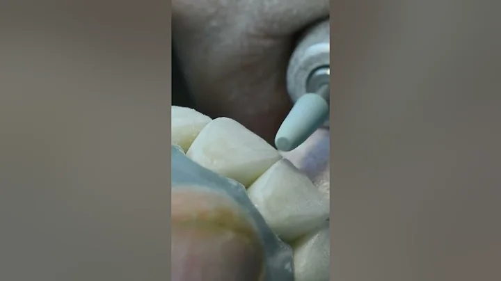 Art of layering technique.
