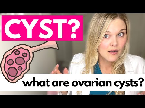 OVARIAN CYSTS: What Causes Ovarian Cysts?