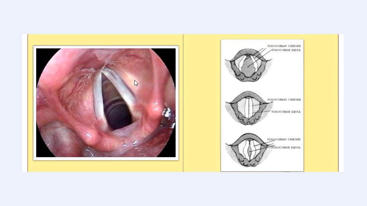 9 Ложные голосовые связки. Курс по вокалу - YouTube