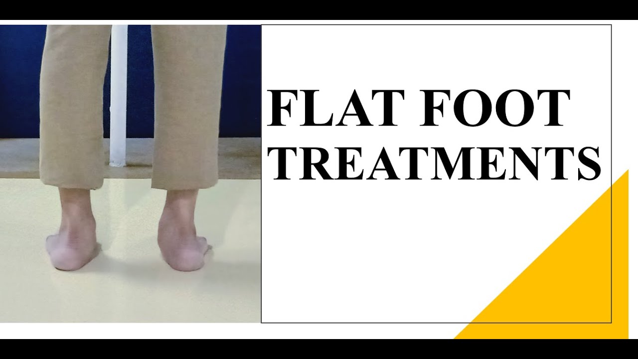 Four Best Exercises for Flat foot, Over Pronated Foot (Causing Ankle ...