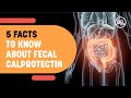 5 Facts To Know About Fecal Calprotectin