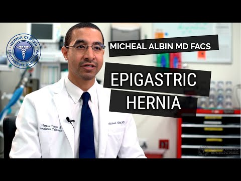 Epigastric Hernia: Causes, Symptoms, Diagnosis, Treatment. Explained by Michael Albin, M.D. F.A.C.S