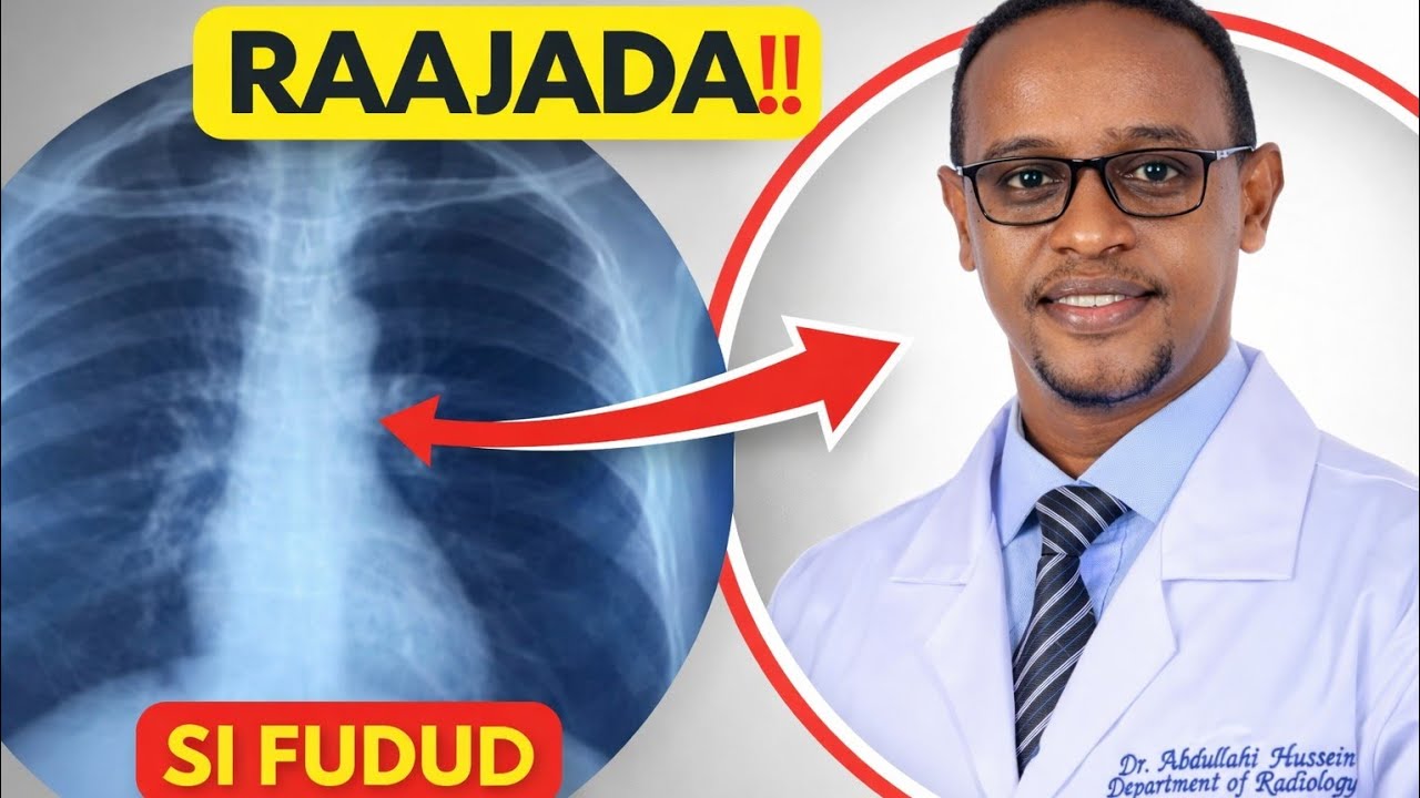 Sidee Raajada (X-ray) u Shaqeysaa? Radiology Somalia 