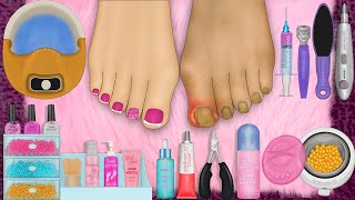 ASMR 🎧 foot care Animation / ingrown toenail / corn removal / deep clean ✨🥰 (full part)