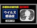 【診療放射線技師国家試験】 ウイルス感染症