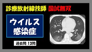 【診療放射線技師国家試験】 ウイルス感染症