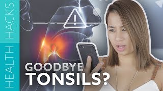 5 Signs You Need Your Tonsils Removed