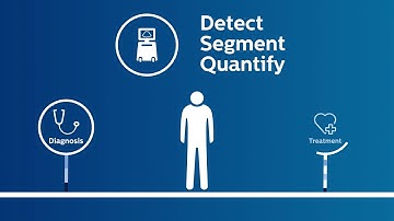 Philips Abdominal Aortic Aneurysm Model solution video