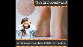 Waxzaa Professional Pedicure Set Foot Files - Best Kit To Remove Hard Skin From Feet