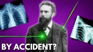 How This Man Accidentally Discovered X-Rays
