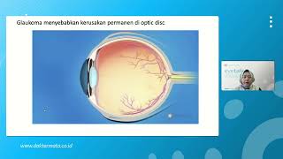 Mencegah Glaukoma (Menyebabkan Kebutaan Permanen) - dr. Danti Ayu Irawati, Sp.M