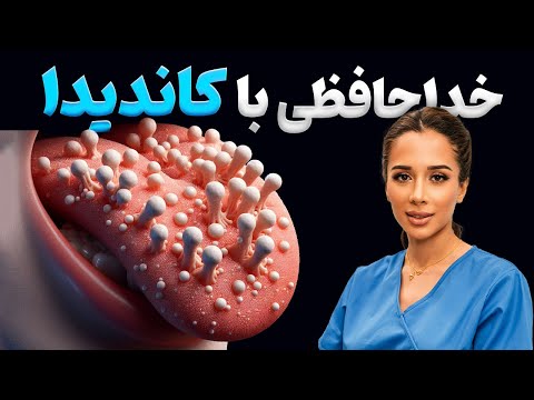 چرا زبانت سفید هست علت کاندیدا در دهان دکتر رضایی
