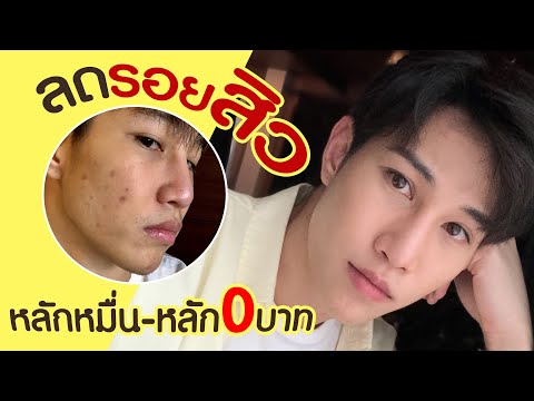 ลดรอยสิว ผิวกระจ่างใส รวดเร็ว ทันใจ รอยสิวไม่ขึ้นซ้ำ! | เอามั้ยลองไมค์