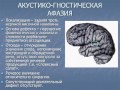 Афазия диагностика и лечение  Ekaterina Drozdova