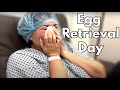 Egg Retrieval Day | Infertility With Endometriosis IVF | Victory Reproductive Care