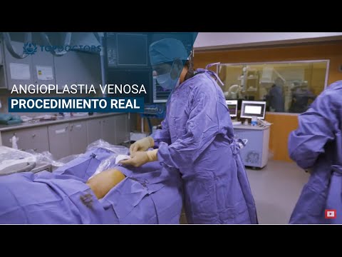 Vídeo: Angioplastia De Arteria Periférica Y Colocación De Stent