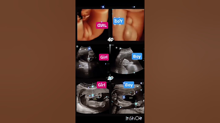 Baby boy and baby girl ultrasound