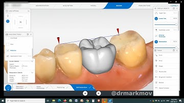 Cerec Primescan Measure Tool for Designing