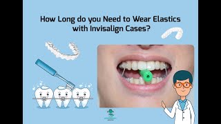 How Long do you Wear Elastics for with Invisalign?