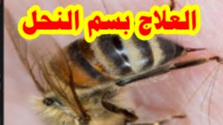سم النحل علاج رباني يفوق الخيال