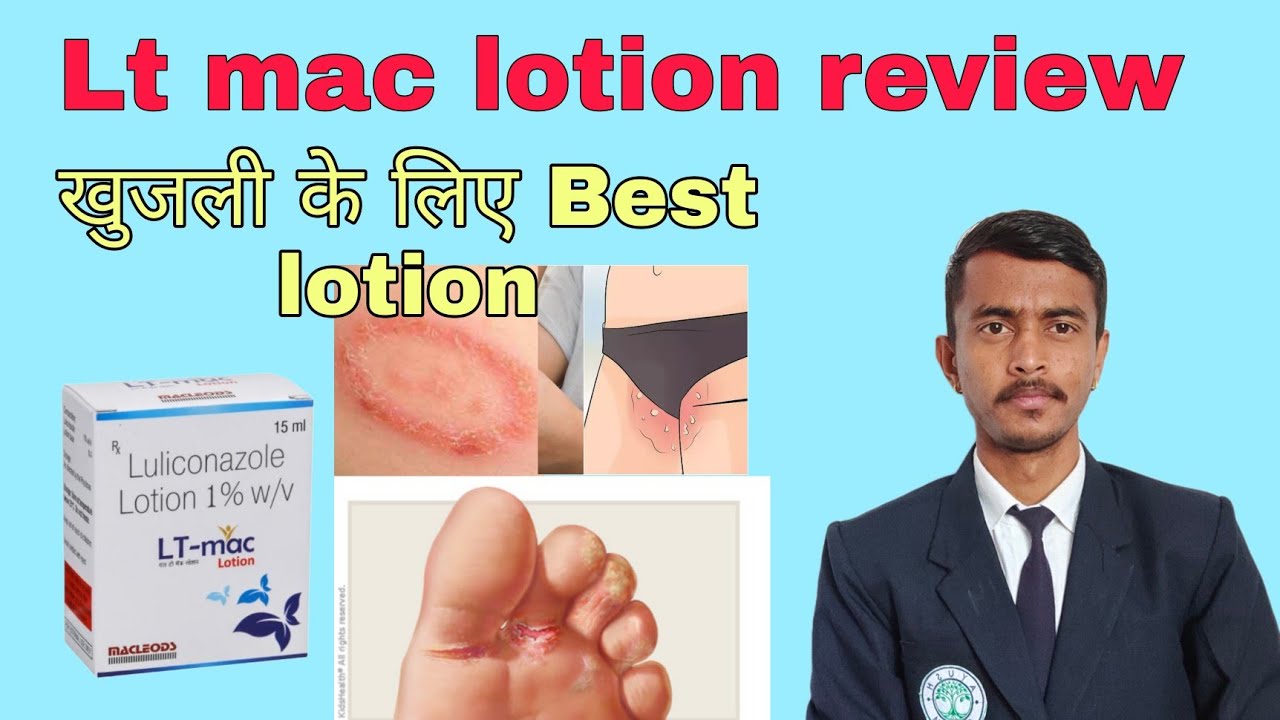 Lt Mac Lotion review | Lt mac lotion | Fungal infection 