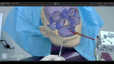 Early prototype of our system running with Vuforia