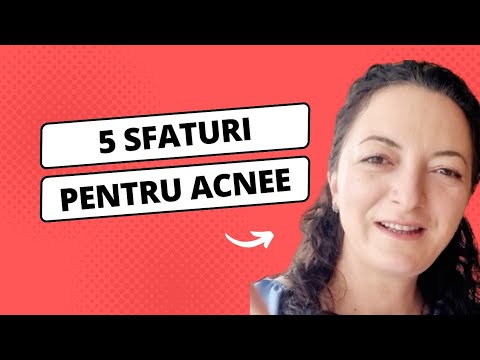 5 sfaturi pentru acnee