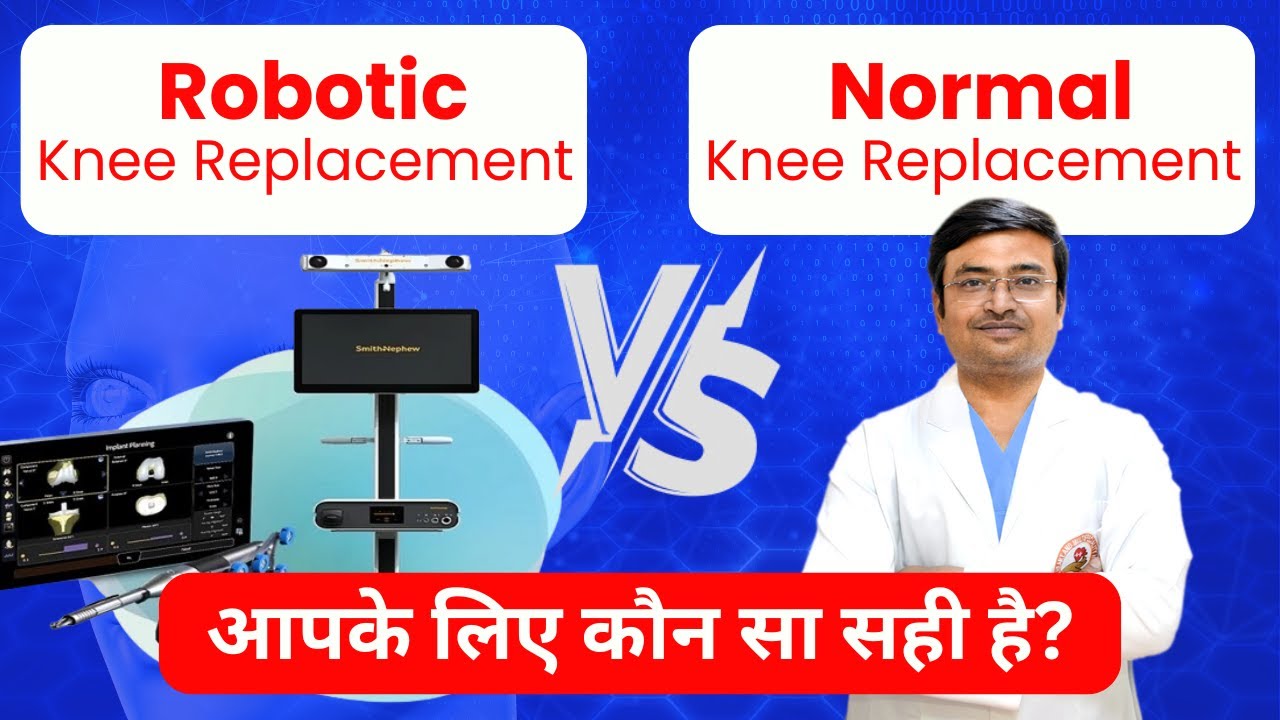 रोबोटिक या सामान्य घुटना रिप्लेसमेंट: आपके लिए कौन सा सही है? I Normal ...