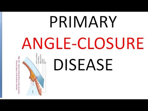 Ophthalmology Primary Angle Closure Disease Glaucoma PACG Suspect