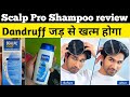 scalp pro shampoo review | scalpe pro anti dandruff shampoo review
