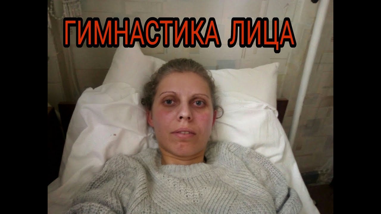 Паралич лицевого нерва. Гимнастика для лица. Воспаление тройничного ...