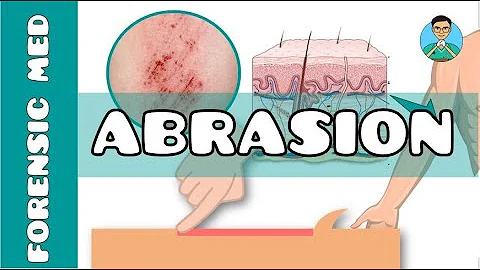 Abrasion | What are the causes of abrasion? | What are types of abrasion - DayDayNews