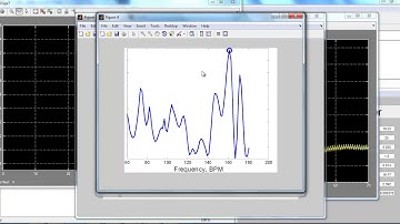 matlab projects on signal processing | matlab thesis on signal processing