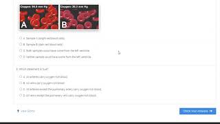 Gizmo questions Week 11 Circulatory System