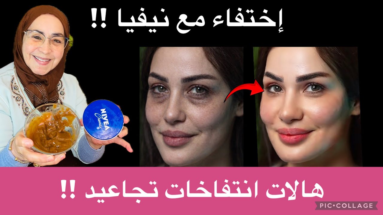 20 دقيقة فقط حول العين… والنتيجة ستبهرك! سر  كريم نيفيا الذي أنهى الهالات والتجاعيد