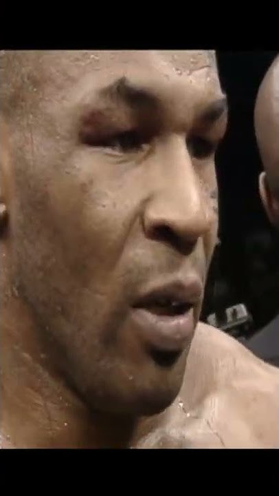 Mike Tyson I Broke My Back Video Mike Tyson - "I broke my back Spinal" HD Interviewclip - YouTube